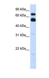 Transfected 293T cell lysate. Antibody concentration: 1.0 ug/ml. Gel concentration: 12%.