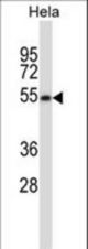 MAVS Antibody western blot of HeLa cell line lysates (35 ug/lane). The MAVS antibody detected the MAVS protein (arrow).