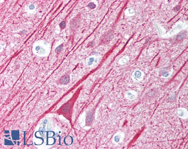 Anti-MAVS antibody IHC of human brain, cortex. Immunohistochemistry of formalin-fixed, paraffin-embedded tissue after heat-induced antigen retrieval. Antibody LS-B1435 concentration 5 ug/ml.
