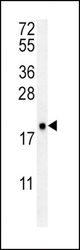 VKORC1 Antibody western blot of NCI-H460 cell line lysates (35 ug/lane). The VKORC1 antibody detected the VKORC1 protein (arrow).