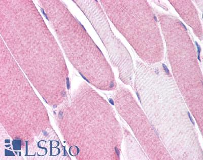 Anti-BEST3 antibody LS-A8638 IHC of human skeletal muscle. Immunohistochemistry of formalin-fixed, paraffin-embedded tissue after heat-induced antigen retrieval.
