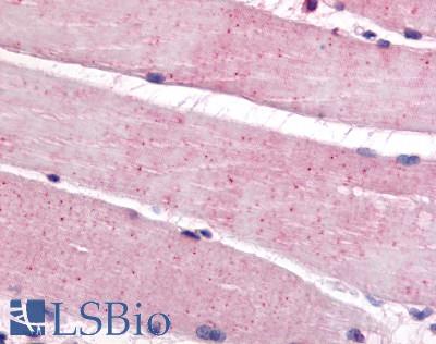 Anti-BEST3 antibody LS-A8639 IHC of human skeletal muscle. Immunohistochemistry of formalin-fixed, paraffin-embedded tissue after heat-induced antigen retrieval.