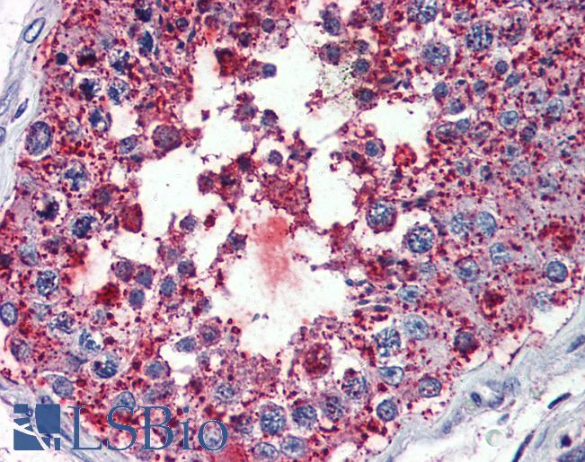 Anti-BEST3 antibody LS-A8641 IHC of human testis. Immunohistochemistry of formalin-fixed, paraffin-embedded tissue after heat-induced antigen retrieval.