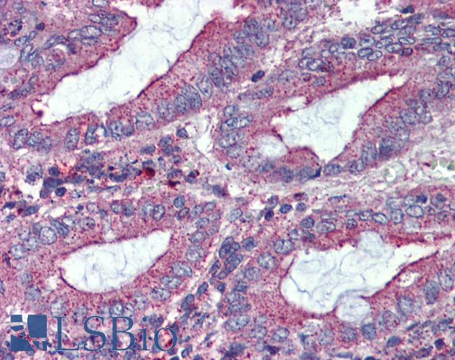 Anti-BEST3 antibody LS-A8641 IHC of human colon. Immunohistochemistry of formalin-fixed, paraffin-embedded tissue after heat-induced antigen retrieval.