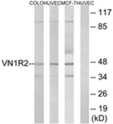 Western blot of extracts from HUVEC/COLO/MCF-7 cells, using VN1R2 Antibody. The lane on the right is treated with the synthesized peptide.