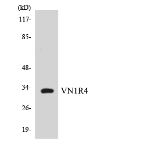 Western blot of the lysates from COLO205 cells using VN1R4 antibody.
