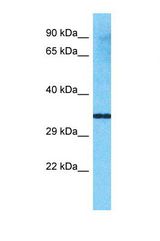 Western blot of Human Placenta. VN1R4 antibody dilution 1.0 ug/ml.