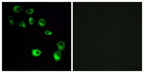 Immunofluorescence of MCF7 cells, using VN1R4 Antibody. The picture on the right is treated with the synthesized peptide.