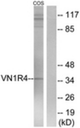 Western blot of extracts from COS7 cells, using VN1R4 Antibody. The lane on the right is treated with the synthesized peptide.