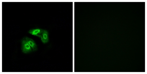 Immunofluorescence of A549 cells, using VN1R5 Antibody. The picture on the right is treated with the synthesized peptide.