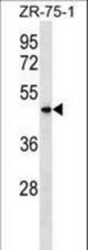 VN1R5 Antibody western blot of ZR-75-1 cell line lysates (35 ug/lane). The VN1R5 antibody detected the VN1R5 protein (arrow).