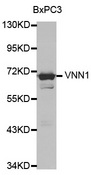 Western blot analysis of extracts of various cell lines, using VNN1 antibody.