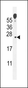 ECOP Antibody western blot of mouse lung tissue lysates (35 ug/lane). The ECOP antibody detected the ECOP protein (arrow).