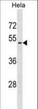 VIPR2 Antibody western blot of HeLa cell line lysates (35 ug/lane). The VIPR2 antibody detected the VIPR2 protein (arrow).