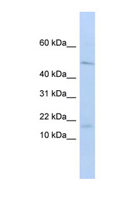 VPREB1 antibody LS-C101959 Western blot of HepG2 cell lysate.