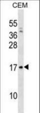 VPREB1 Antibody western blot of CEM cell line lysates (35 ug/lane). The VPREB1 antibody detected the VPREB1 protein (arrow).