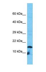 Western blot of VPREB3 Antibody with HT1080 Whole Cell lysate.