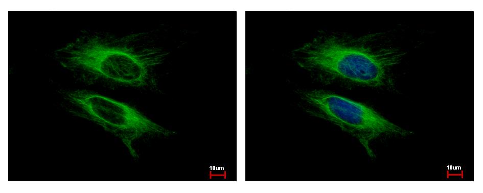 VPS11 antibody detects VPS11 protein at cytoplasm by immunofluorescent analysis. HeLa cells were fixed in -20 100% MeOH for 5 min. VPS11 protein stained by VPS11 antibody diluted at 1:500. 