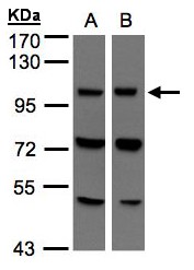 Sample (30 ug of whole cell lysate). A:293T, B: Hep G2. 7.5% SDS PAGE. VPS11 antibody diluted at 1:500
