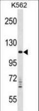 VPS11 Antibody western blot of K562 cell line lysates (35 ug/lane). The VPS11 antibody detected the VPS11 protein (arrow).