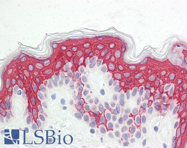 Anti-VPS13B antibody IHC staining of human skin. Immunohistochemistry of formalin-fixed, paraffin-embedded tissue after heat-induced antigen retrieval.