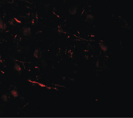 Immunofluorescence of COH1 in human brain tissue with COH1 antibody at 20 ug/ml.