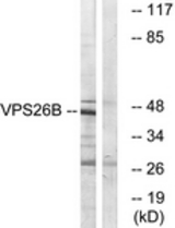 Western blot of extracts from LOVO cells, using VPS26B Antibody. The lane on the right is treated with the synthesized peptide.