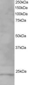 Antibody staining (1 ug/ml) of Human Testis lysate (RIPA buffer, 35 ug total protein per lane). Primary incubated for 1 hour. Detected by Western blot of chemiluminescence.