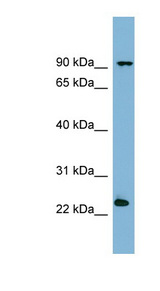 VPS29 antibody LS-C108024 Western blot of ACHN lysate.