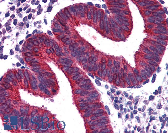 Anti-VPS29 antibody IHC of human uterus. Immunohistochemistry of formalin-fixed, paraffin-embedded tissue after heat-induced antigen retrieval. Antibody LS-B3946 concentration 3.75 ug/ml.