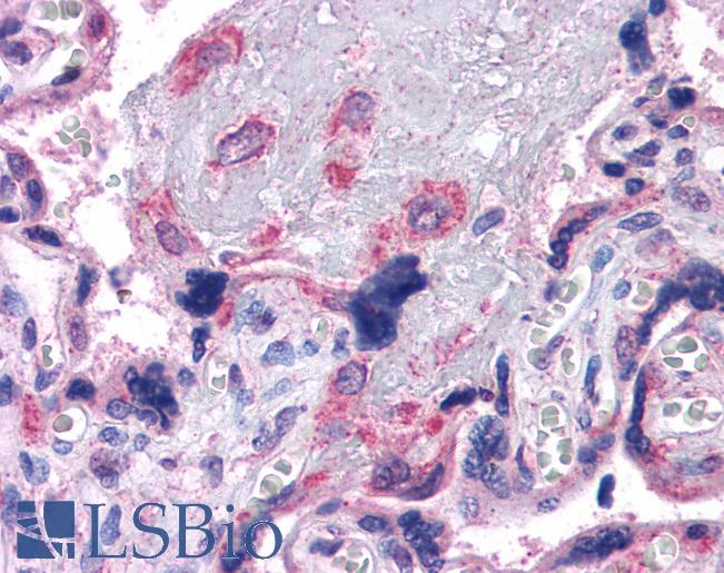 Anti-VPS29 antibody IHC of human placenta. Immunohistochemistry of formalin-fixed, paraffin-embedded tissue after heat-induced antigen retrieval. Antibody LS-B3946 concentration 3.75 ug/ml.
