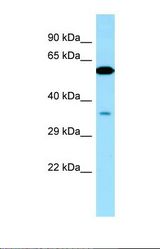 Western blot of Human 721_B . VPS33A antibody dilution 1.0 ug/ml.