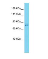 Western blot of Vps35 Antibody - C-terminal region in Mouse Lung cells lysate.