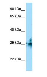 TMUB2 antibody Western Blot of Fetal Skin.