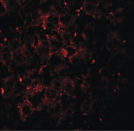 Immunofluorescence of VPS39 in mouse liver tissue with VPS39 antibody at 20 ug/ml.