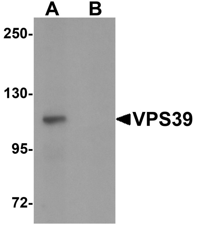Western blot analysis of VPS39 in rat liver tissue lysate with VPS39 antibody at 0.5 ug/ml in (A) the absence and (B) the presence of blocking peptide.