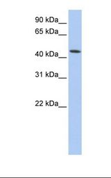 Fetal muscle lysate. Antibody concentration: 1.0 ug/ml. Gel concentration: 12%.