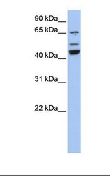 Fetal brain lysate. Antibody concentration: 1.0 ug/ml. Gel concentration: 12%.