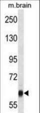 VPS45 Antibody western blot of mouse brain tissue lysates (35 ug/lane). The VPS45 antibody detected the VPS45 protein (arrow).