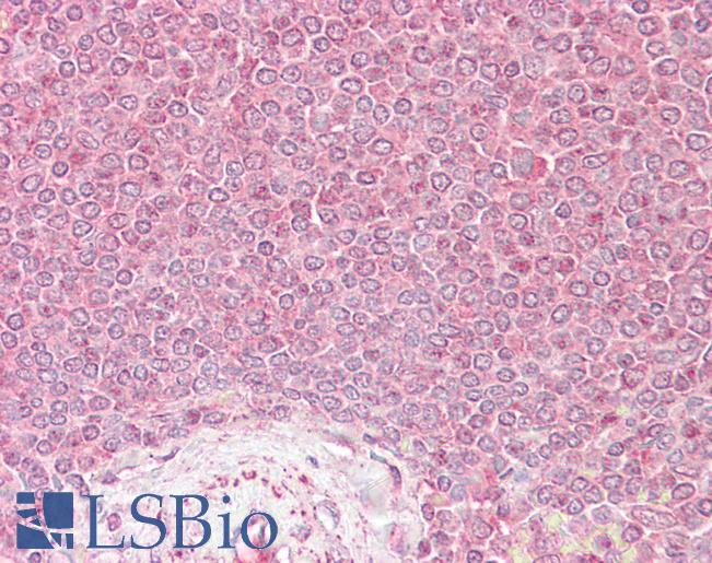 Anti-VPS45 antibody IHC of human spleen. Immunohistochemistry of formalin-fixed, paraffin-embedded tissue after heat-induced antigen retrieval. Antibody LS-B6464 concentration 2.5 ug/ml.