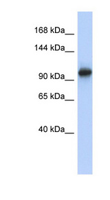 VPS54 antibody LS-C111824 Western blot of Placenta lysate.
