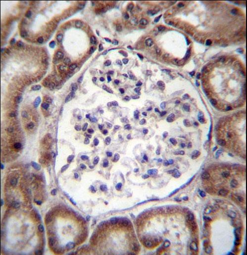 VPS54 Antibody immunohistochemistry of formalin-fixed and paraffin-embedded human kidney tissue followed by peroxidase-conjugated secondary antibody and DAB staining.