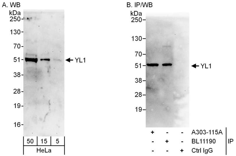 Detection of Human YL1 by Western Blot and Immunoprecipitation. Samples: Whole cell lysate (5, 15 and 50 ug for WB; 1 mg for IP, 20% of IP loaded) from HeLa cells. Antibodies: Affinity purified rabbit anti-YL1 antibody used for WB at 0.1 ug/ml (A) and 1 ug/ml (B) and used for IP at 6 ug/mg lysate. YL1 was also immunoprecipitated by rabbit anti-YL1 antibody BL11190, which recognizes a downstream epitope. Detection: Chemiluminescence with exposure times of 3 minutes (A) and 10 seconds (B).