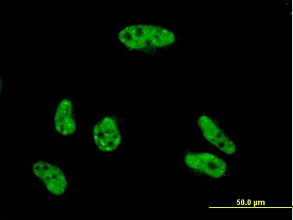 Immunofluorescence of monoclonal antibody to VPS72 on HeLa cell . [antibody concentration 10 ug/ml]