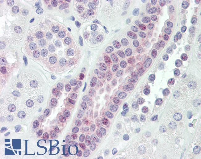 Anti-VPS72 antibody IHC of human kidney. Immunohistochemistry of formalin-fixed, paraffin-embedded tissue after heat-induced antigen retrieval. Antibody LS-B8421 dilution 10 ug/ml.