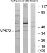 Western blot of extracts from RAW264.7/NIH-3T3 cells, using VPS72 Antibody. The lane on the right is treated with the synthesized peptide.