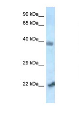 VPS72 antibody LS-C145532 Western blot of Mouse Heart lysate. Antibody concentration 1 ug/ml.