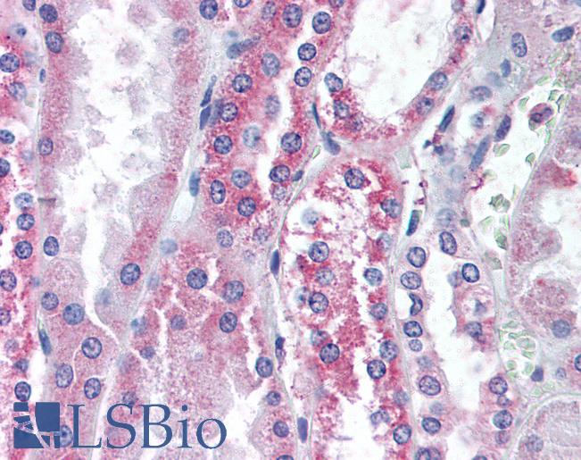 Anti-TRPV1 antibody LS-A9670 IHC of human kidney. Immunohistochemistry of formalin-fixed, paraffin-embedded tissue after heat-induced antigen retrieval.