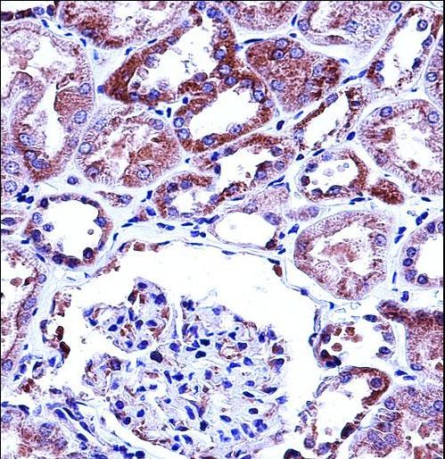TRPV1 Antibody immunohistochemistry of formalin-fixed and paraffin-embedded human kidney tissue followed by peroxidase-conjugated secondary antibody and DAB staining.