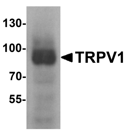 Western blot analysis of TRPV1 in K562 cell lysate with TRPV1 antibody at 1 ug/ml.